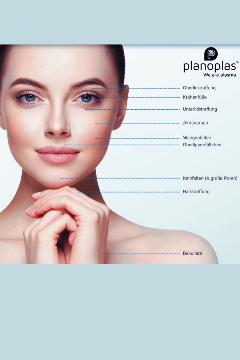 Planoplas 2